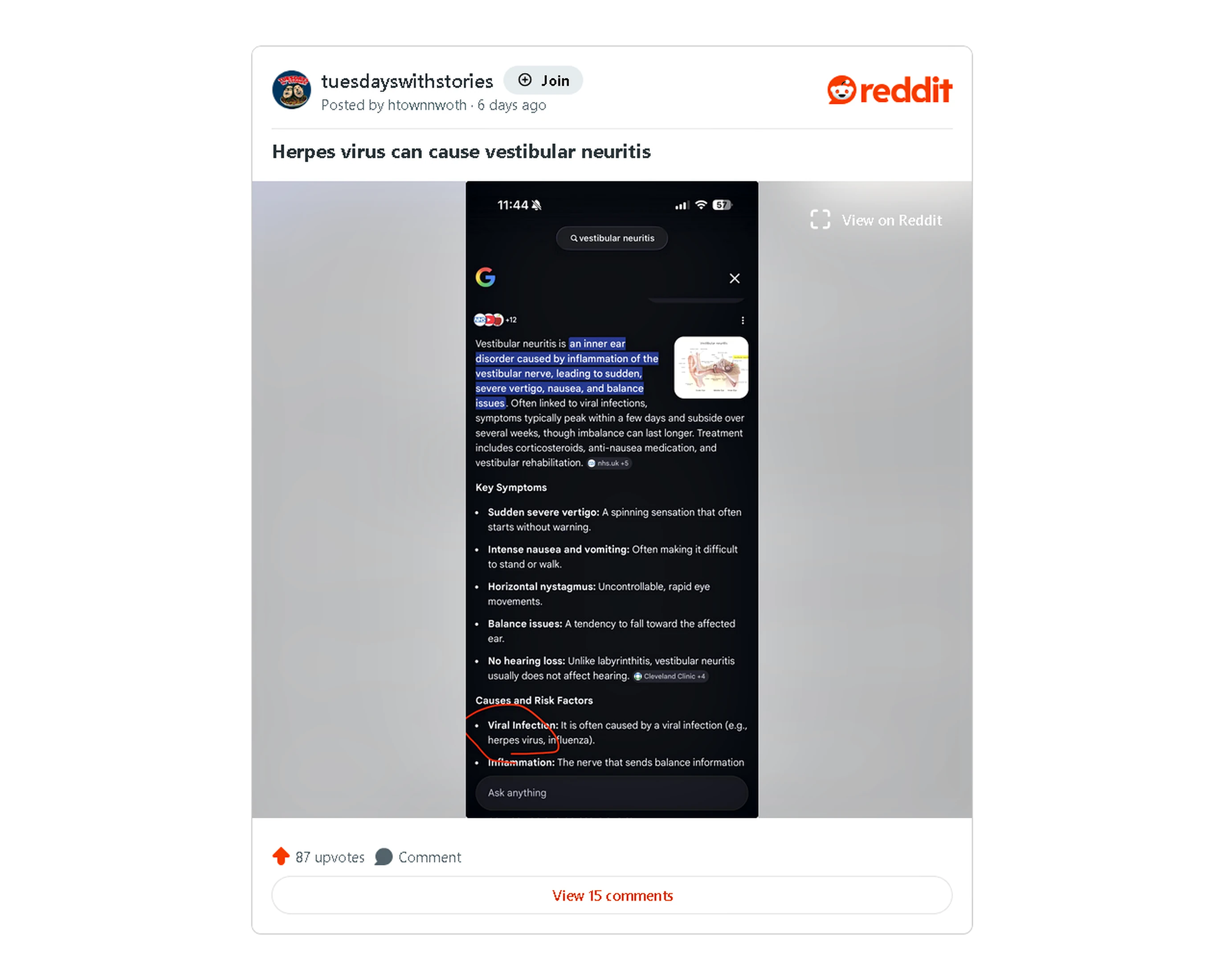 Second Best Reddit Post